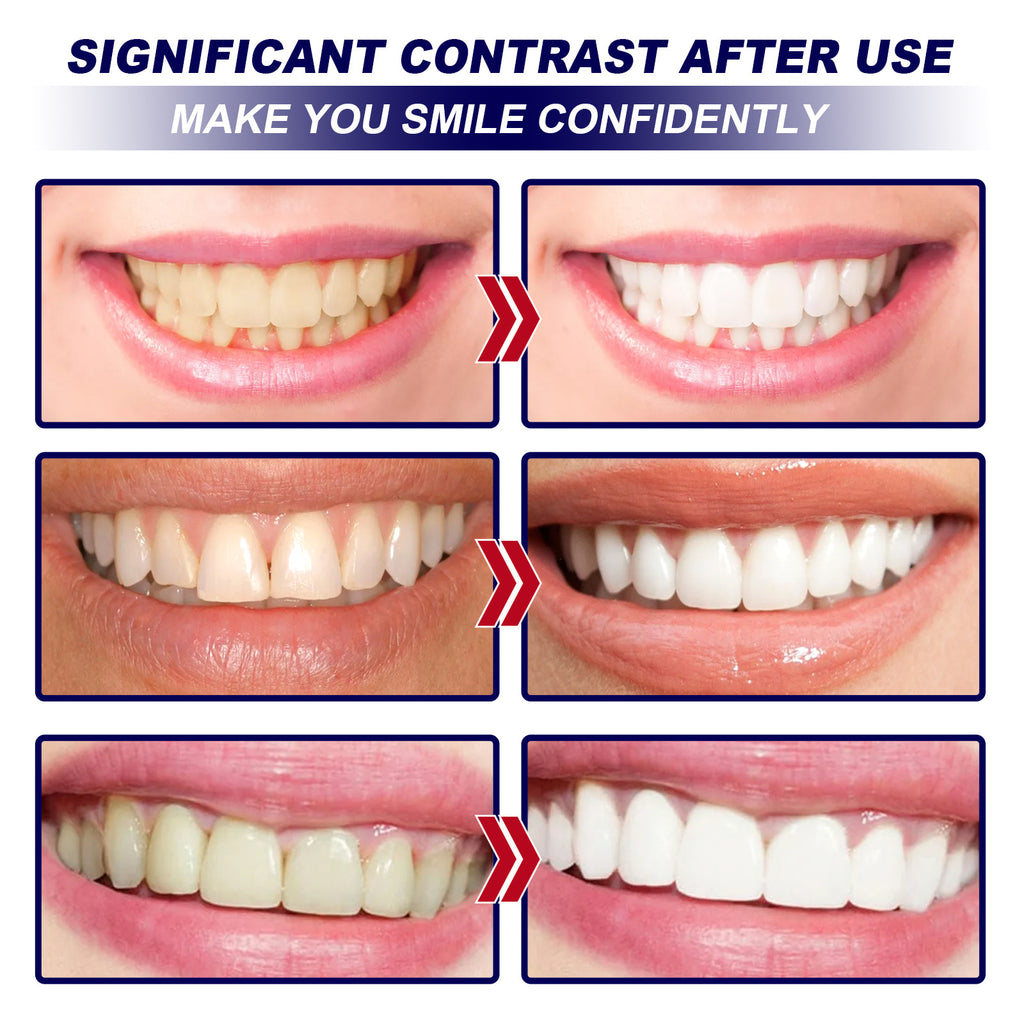 Whitening Tooth Patch Care