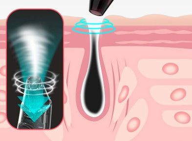 Visual Blackhead Acne Remover To Suck Blackheads